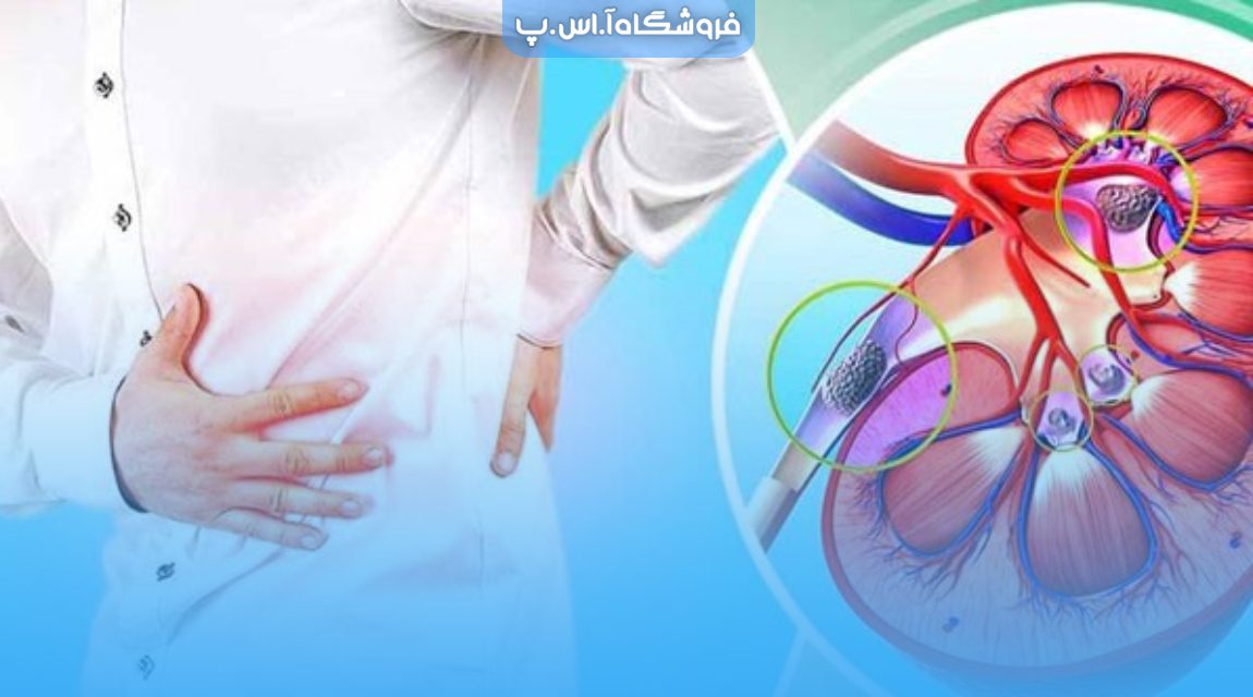 نارسایی کلیه چیست و چه علائمی دارد ؟ 